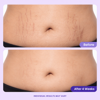 GlowFirm™ - Advanced Belly Firming & Smoothing Cream