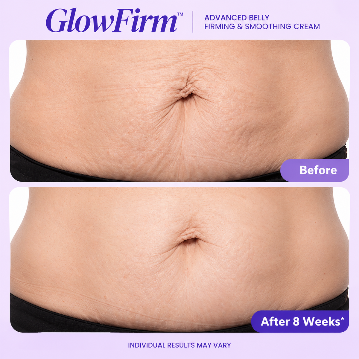 GlowFirm™ - Advanced Belly Firming & Smoothing Cream